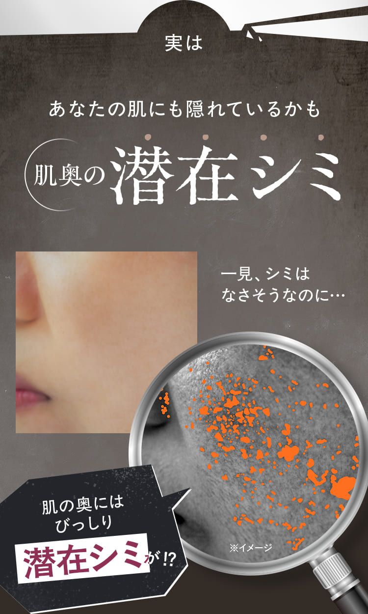 実はあなたの肌にも隠れているかも肌奥の潜在シミが!？